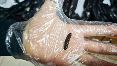 Eldivenli bir elin üzerinde bulunan canlı sülük
